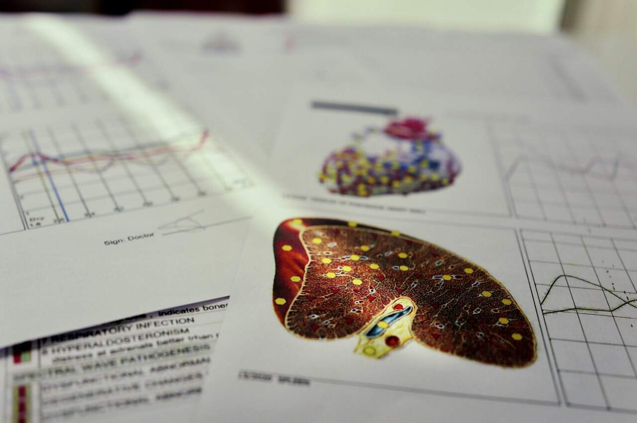 Nls Health Screening Results Liver Analysis Chart Data Visualization Medical Report - integrative healthcare treatment at Healers Clinic Dubai