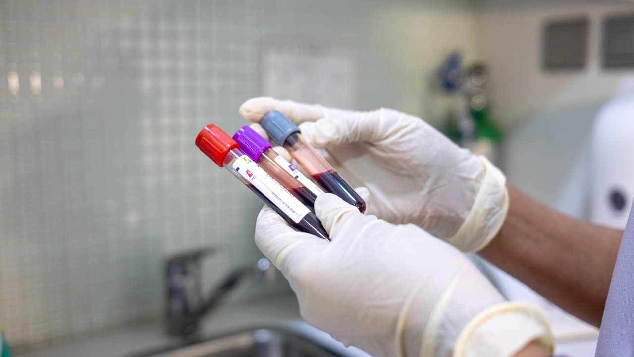 Blood Test Tubes Laboratory Analysis Gloved Hands Clinical Precision - integrative healthcare treatment at Healers Clinic Dubai