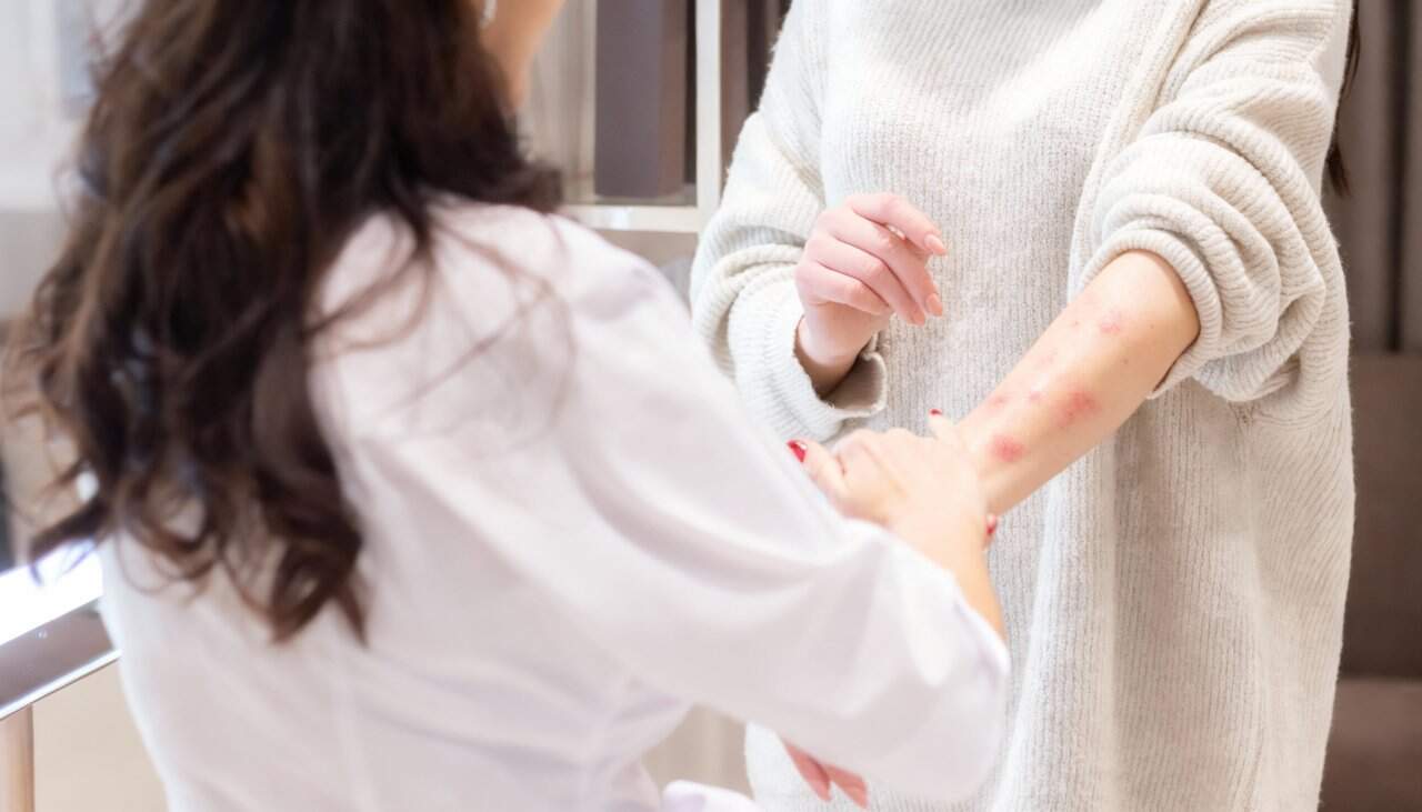 Allergy Care Hero - integrative healthcare treatment at Healers Clinic Dubai
